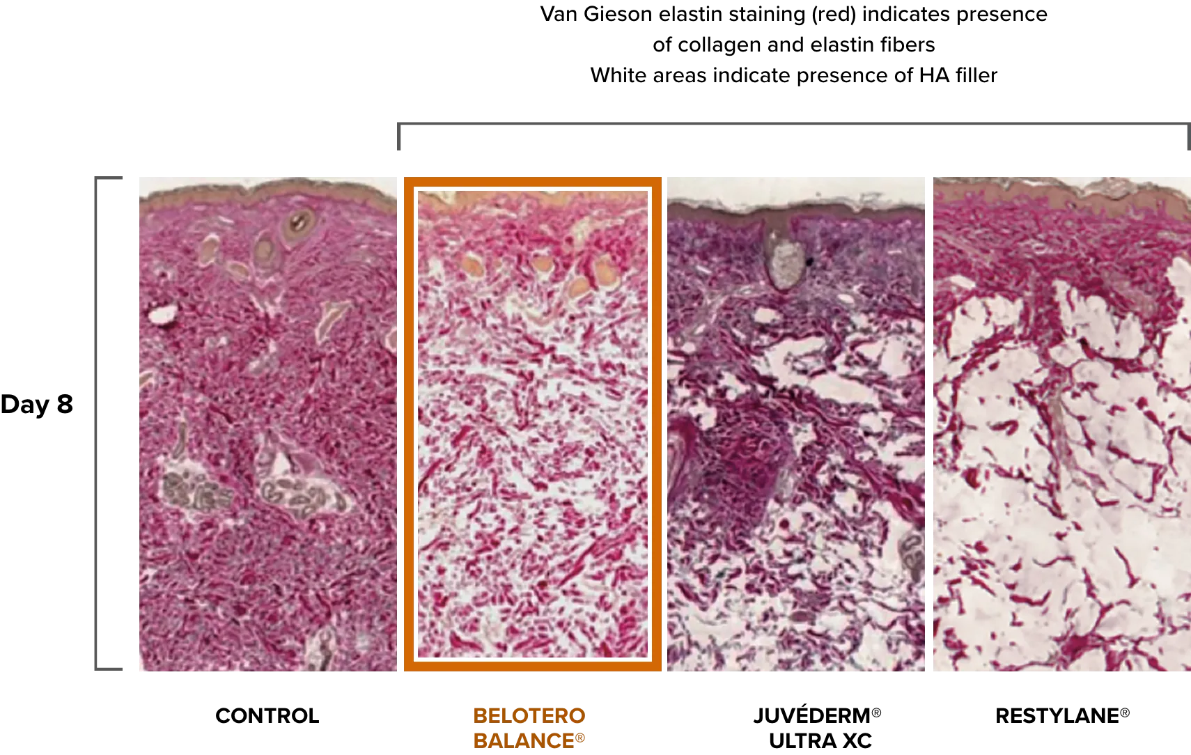 Van Gieson elastin staining comparison after 8 days of control, Belotero Balance, Juvéderm Ultra XC, and Restylane