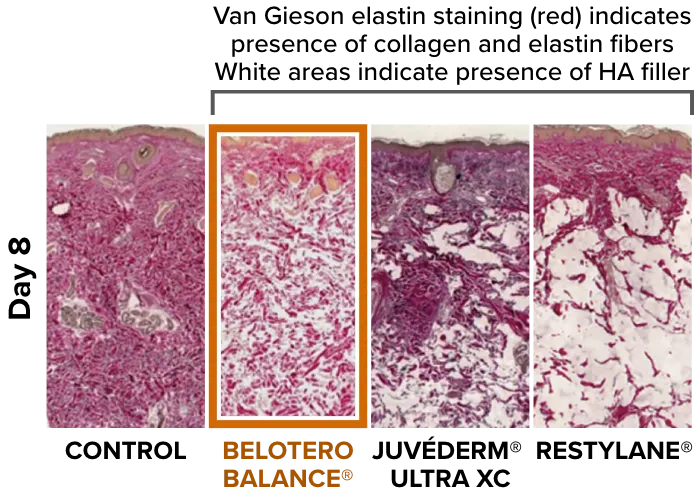 Van Gieson elastin staining comparison after 8 days of control, Belotero Balance, Juvéderm Ultra XC, and Restylane